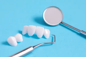 Read more about the article What Do Teeth Look Like Under Veneers?