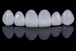 Read more about the article Veneers vs. Crowns: Addressing Both Aesthetic and Functional Concerns