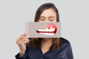 Read more about the article What Causes Gum Disease and How Can You Prevent It?