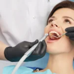 What Happens During A Professional Dental Cleaning?